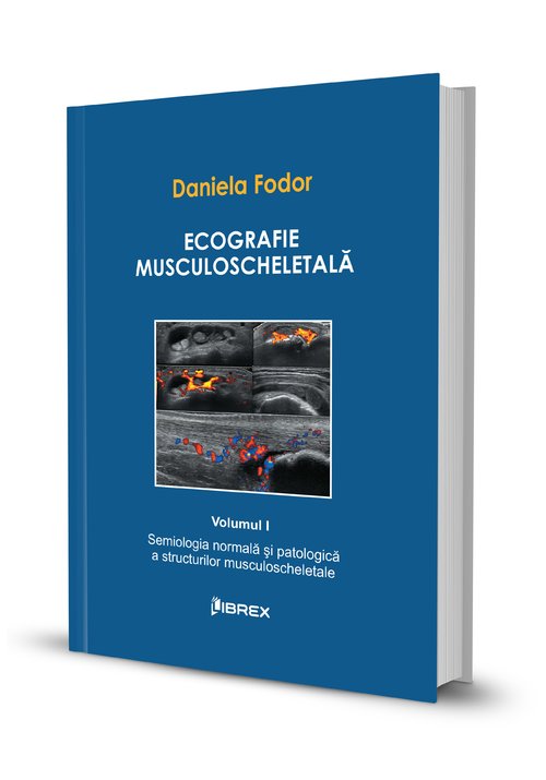 Ecografie musculoscheletală – Daniela Fodor – Vol. I Librex Publishing poza 2022